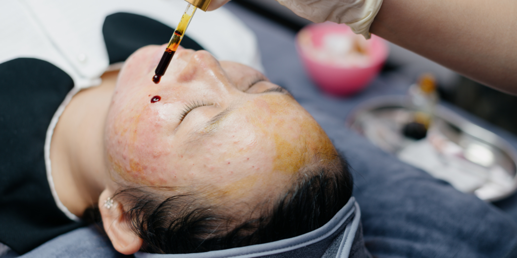 Tima Cấy meso căng bóng